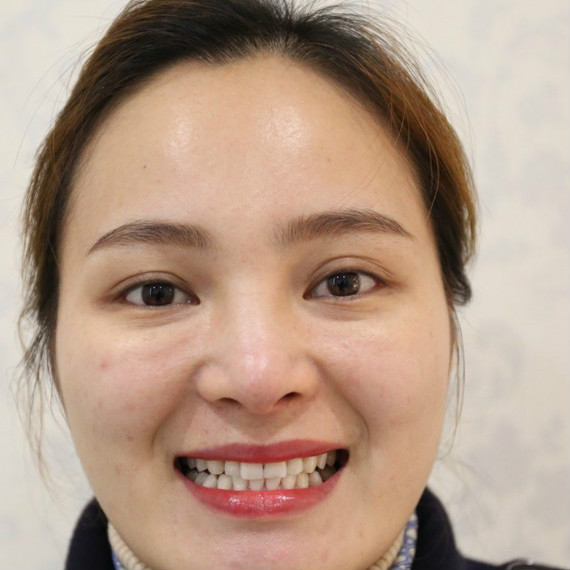 牙齿暗黄就用冷光美白，牙齿美白效果真的棒