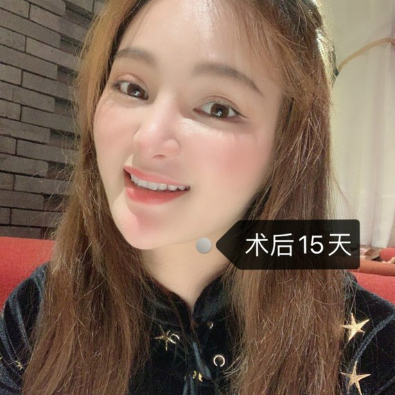 牙齿暗黄就用冷光美白，牙齿美白效果真的棒